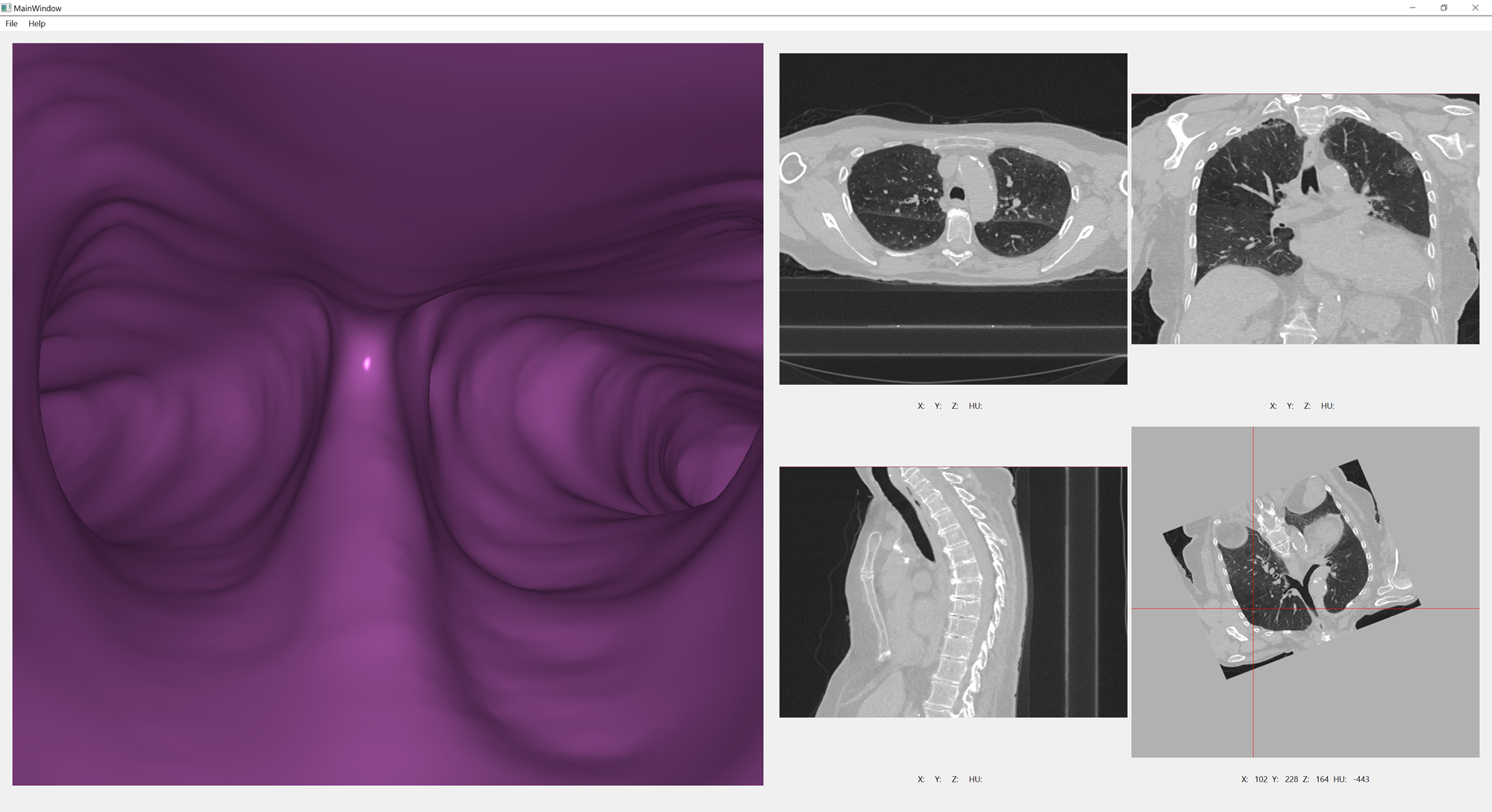 Oblique Slicer Reoriented