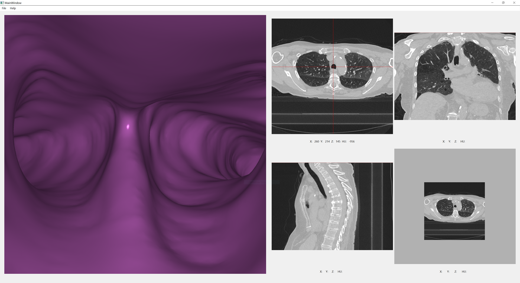 Airway Navigator User Interface